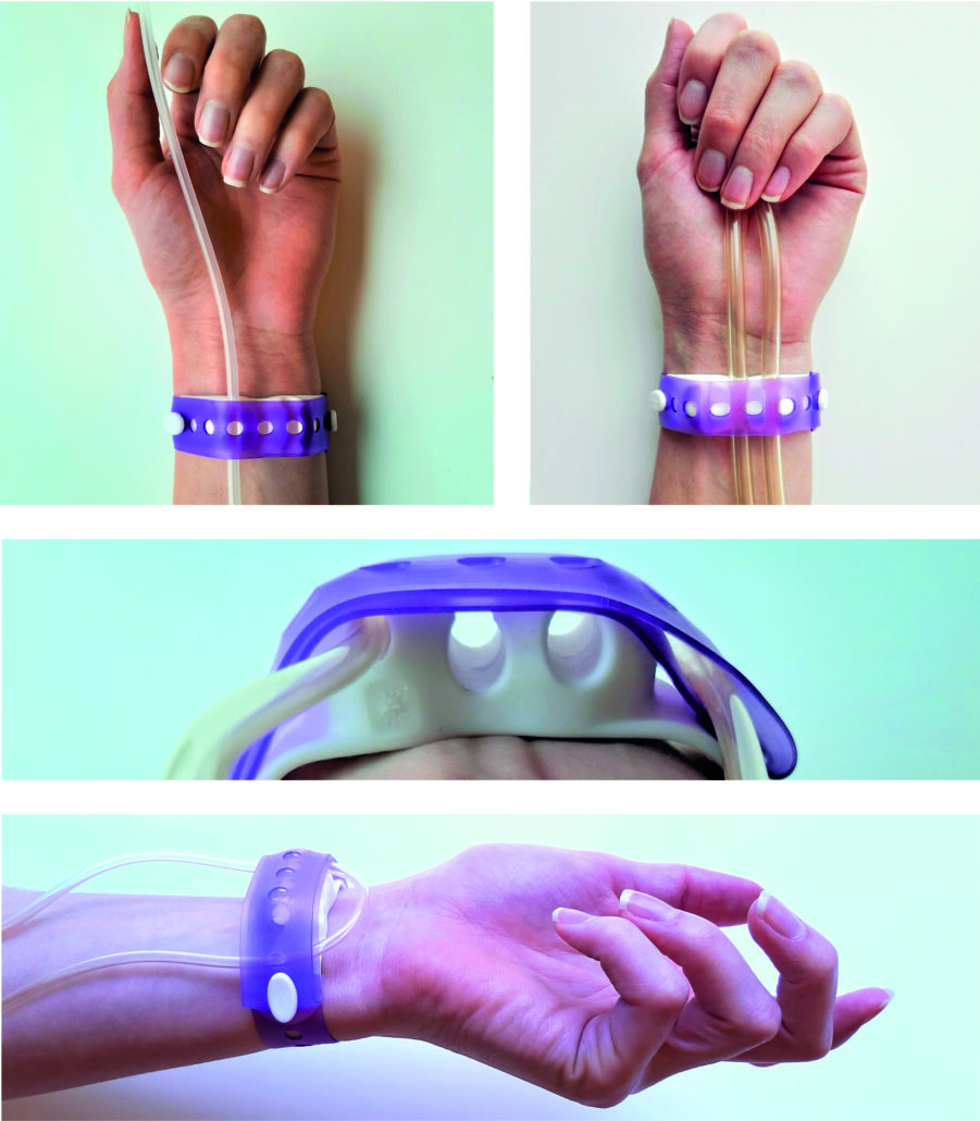 IV-bracelet - securement device for iv line and dialysis bloodlines